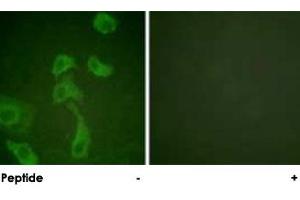 Immunofluorescence analysis of HeLa cells, using IL2RB polyclonal antibody . (IL2 Receptor beta Antikörper)