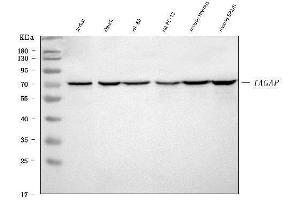 Western blot analysis of TAGAP using anti-TAGAP antibody (ABIN7606441).