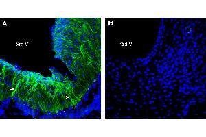Expression of FSHR in rat hypothalamus. (FSHR Antikörper  (Extracellular))