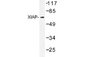 Image no. 1 for anti-X-Linked Inhibitor of Apoptosis (XIAP) antibody (ABIN272094) (XIAP Antikörper)