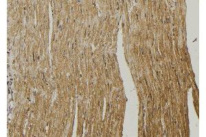 ABIN6272949 at 1/100 staining Mouse muscle tissue by IHC-P. (RDH10 Antikörper  (Internal Region))