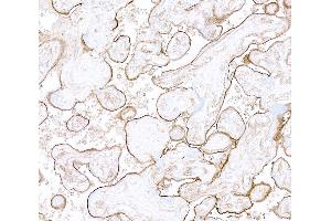 Immunohistochemistry (IHC) image for anti-Thrombomodulin (THBD) (AA 17-515) antibody (ABIN7795643) (Rekombinanter Thrombomodulin Antikörper  (AA 17-515))