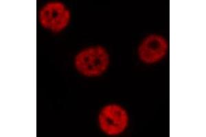 ABIN6275418 staining  NIH-3T3 cells by IF/ICC. (S100A16 Antikörper  (Internal Region))