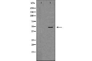 Western blot analysis of K562 whole cell lysates, using TNFRSF11B  Antibody. (Osteoprotegerin Antikörper  (Internal Region))