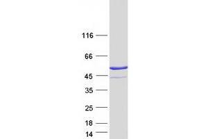 Western Blotting (WB) image for Protein Kinase, CAMP-Dependent, Regulatory, Type I, alpha (Tissue Specific Extinguisher 1) (PRKAR1A) (Transcript Variant 2) protein (Myc-DYKDDDDK Tag) (ABIN2729581)