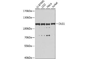 Western blot analysis of extracts of various cell lines, using DLG1 antibody (ABIN6130273, ABIN6139646, ABIN6139648 and ABIN6224636) at 1:1000 dilution. (DLG1 Antikörper  (AA 1-190))
