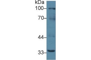 Western Blot; Sample: Mouse Liver lysate; Primary Ab: 2µg/ml Rabbit Anti-Mouse RANk Antibody Second Ab: 0. (TNFRSF11A Antikörper  (AA 359-542))