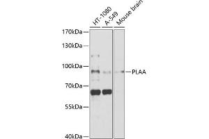 Western blot analysis of extracts of various cell lines, using PLAA antibody (ABIN1682194, ABIN3018787, ABIN3018788 and ABIN6220577) at 1:1000 dilution. (PLAA Antikörper  (AA 536-795))