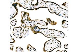 IHC analysis of CBX2 using anti-CBX2 antibody (ABIN7599466).