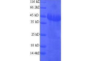 GNAO1 Protein (AA 2-354) (His tag)