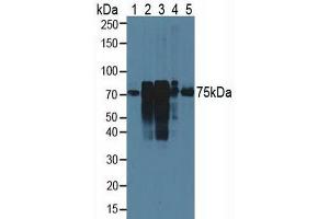 Western blot analysis of (1) Rat Serum, (2) Rat Lung Tissue, (3) Rat Placenta Tissue, (4) Rat Uterus Tissue and (5) Human HeLa cells. (Cortactin Antikörper  (AA 1-509))