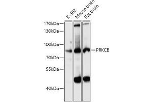 Western blot analysis of extracts of various cell lines, using PRKCB antibody (ABIN6128463, ABIN6146200, ABIN6146202 and ABIN6221544) at 1:3000 dilution. (PKC beta Antikörper  (AA 220-340))