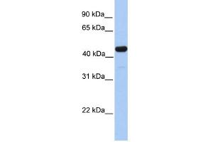 WB Suggested Anti-GAL3ST3 Antibody Titration:  0.