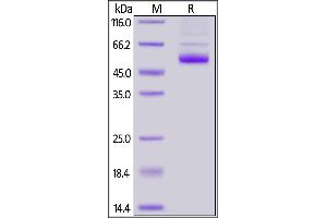 Human TNFSF11, Fc Tag on  under reducing (R) condition. (RANKL Protein (AA 64-245) (Fc Tag))