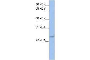 WB Suggested Anti-FKBP3  Antibody Titration: 0. (FKBP3 Antikörper  (C-Term))