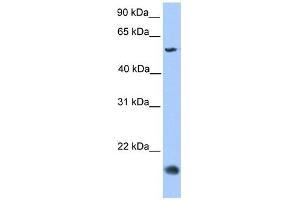CMTM8 antibody used at 1 ug/ml to detect target protein. (CMTM8 Antikörper  (Middle Region))