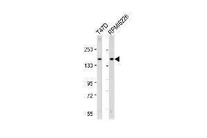 All lanes : Anti-ABCC12 Antibody (Center) at 1:2000 dilution Lane 1: T47D whole cell lysate Lane 2: R whole cell lysate Lysates/proteins at 20 μg per lane. (ABCC12 Antikörper  (AA 723-752))