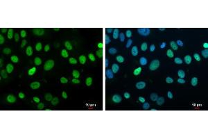 ICC/IF Image Rb antibody detects Rb protein at nucleus by immunofluorescent analysis. (Retinoblastoma 1 Antikörper  (C-Term))