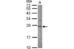 WB Image Sample (50 ug of whole cell lysate) A: mouse kidney 12% SDS PAGE antibody diluted at 1:1000 (PGPEP1 Antikörper)