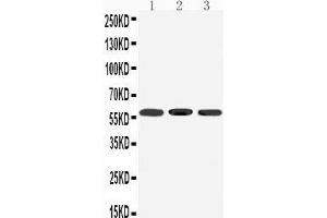 Western Blotting (WB) image for anti-Dopamine Receptor D5 (DRD5) (AA 388-407), (C-Term) antibody (ABIN3042836) (DRD5 Antikörper  (C-Term))