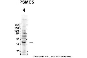 Sample Type: 4. (PSMC5 Antikörper  (C-Term))