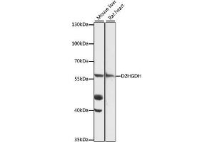 Western blot analysis of extracts of various cell lines, using D2HGDH antibody (ABIN7266669) at 1:1000 dilution. (D2HGDH Antikörper  (AA 322-521))