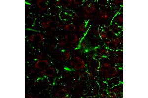 Immunohistochemistry staining of CD107a (red) in tissue sections of murine brain expressing GFP in some of its neurons (green). (LAMP1 Antikörper)