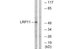 Western blot analysis of extracts from Jurkat cells, using LRP11 antibody. (LRP11 Antikörper)