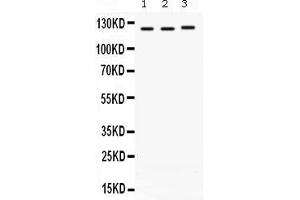 Western blot analysis of CRM1 expression in rat cardiac muscle extract ( Lane 1), mouse brain extract ( Lane 2) and A549 whole cell lysates ( Lane 3).