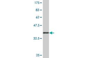 Western Blot detection against Immunogen (36. (FOXP4 Antikörper  (AA 586-679))