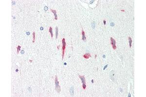 Anti-PRNP / PrP / Prion antibody IHC staining of human brain, cortex. (PRNP Antikörper)