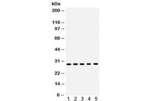 Western blot testing of human 1) MCF7, 2) MM231, 3) MM453, 4) SKOV and 5) HeLa lysate with XBP1 antibody.