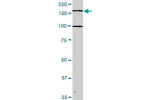 Western Blotting (WB) image for anti-TEK Tyrosine Kinase, Endothelial (TEK) (AA 66-185) antibody (ABIN793004) (TEK Antikörper  (AA 66-185))