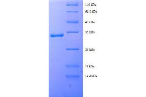 Solute Carrier Family 25 (Mitochondrial Carrier, Citrate Transporter), Member 1 (Slc25a1) (AA 47-87), (partial) protein (GST tag)