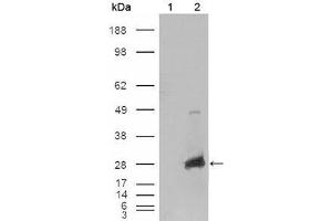 Western Blot showing CRYAB antibody used against HEK293T cells transfected with the pCMV6-ENTRY control (1) and pCMV6-ENTRY CRYAB cDNA (2). (CRYAB Antikörper  (AA 1-175))