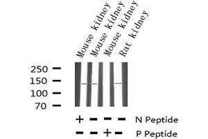 Western blot analysis of Phospho-eNOS (Thr494) expression in various lysates (ENOS Antikörper  (pThr495))