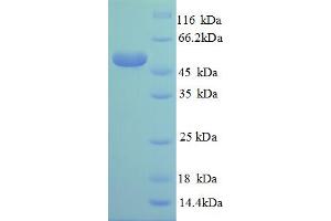 SDS-PAGE (SDS) image for Ribosomal Protein L14 (RPL14) (AA 2-214), (partial) protein (GST tag) (ABIN5712063) (RPL14 Protein (AA 2-214, partial) (GST tag))