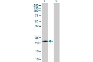 Western Blot analysis of RAB26 expression in transfected 293T cell line by RAB26 MaxPab polyclonal antibody. (RAB26 Antikörper  (AA 1-190))