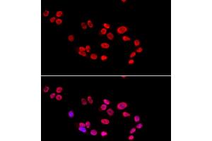 Immunofluorescence analysis of HeLa cells using XRCC5 antibody.