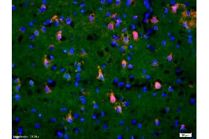 Formalin-fixed and paraffin-embedded rat brain labeled with Anti-Phospho-TAK1(Thr184/187) Polyclonal Antibody, Unconjugated (ABIN746348) 1:200, overnight at 4°C, The secondary antibody was Goat Anti-Rabbit IgG, Cy3 conjugated used at 1:200 dilution for 40 minutes at 37°C. (TR4 Antikörper  (pThr184, pThr187))