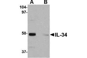 Western Blotting (WB) image for anti-Interleukin 34 (IL34) (Middle Region) antibody (ABIN1030960) (IL-34 Antikörper  (Middle Region))