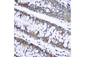 Immunohistochemistry of paraffin-embedded human placenta using Ubiquitin Rabbit pAb (ABIN3022990, ABIN3022991, ABIN3022992 and ABIN6219334) at dilution of 1:100 (40x lens). (Ubiquitin B Antikörper  (AA 1-76))