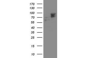 Western Blotting (WB) image for anti-Aldehyde Dehydrogenase 3 Family, Member A2 (ALDH3A2) antibody (ABIN1496596) (ALDH3A2 Antikörper)