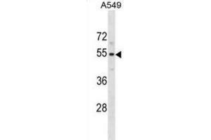 Western Blotting (WB) image for anti-Pseudouridylate Synthase 10 (PUS10) antibody (ABIN3001254) (PUS10 Antikörper)