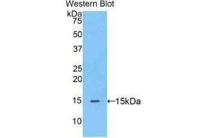 Western blot analysis of the recombinant protein. (PPARD Antikörper  (AA 29-147))