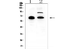 Western blot analysis of CCDC36 using anti-CCDC36 antibody (ABIN6719645). (CCDC36 Antikörper  (AA 172-472))