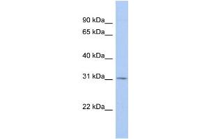 WB Suggested Anti-TSPAN12 Antibody Titration:  0. (TSPAN12 Antikörper  (Middle Region))