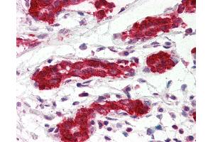 Anti-PDCD4 antibody IHC of human breast. (PDCD4 Antikörper  (AA 1-469))