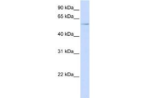 WB Suggested Anti-RIPK3 Antibody Titration:  0. (RIPK3 Antikörper  (N-Term))