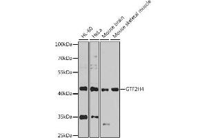 Western blot analysis of extracts of various cell lines, using GTF2H4 antibody  at 1:1000 dilution. (GTF2H4 Antikörper  (AA 1-300))